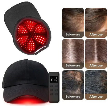 NEW 660Nm 940Nm Red Light Infrared Therapy Hair Growth Cap for Hair Regrowth Antihair Loss Relax Scalp Care Hat anti Hair 2026